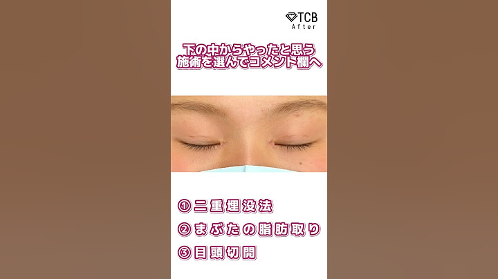 【二重整形】どこを整形したのかわかったらすごい #shorts