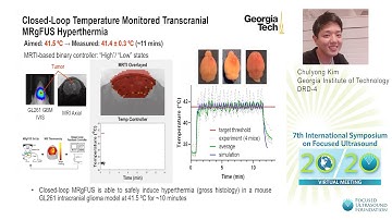 C. Kim - TDD in Brain Tumors Based on Thermal Stress and Thermosensitive Nanocarriers (2020)