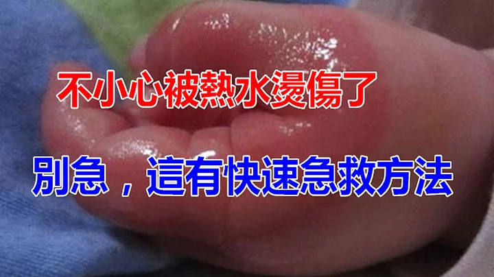 被開水燙傷怎麼辦？快速急救方法，一分鐘就解決！ - 天天要聞