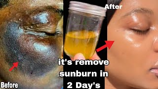 :No joke i tried it! It works 💯! My Face glow back in just 2 days! Now my face looks more brighter