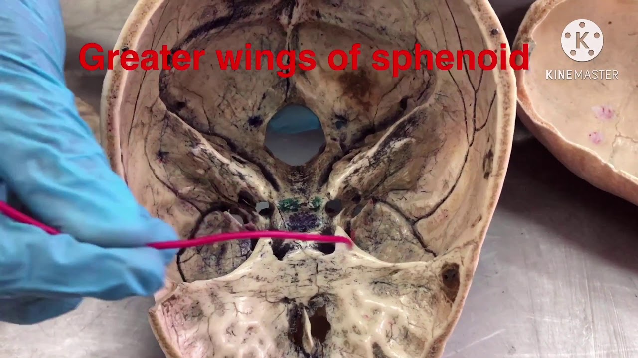 Cranial Bones ( part 2 ) - YouTube