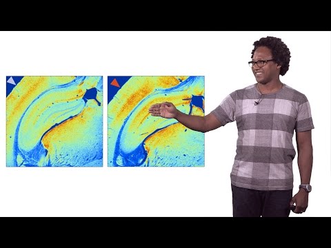 Video: Mis on proteiinkinaasi viktoriin?