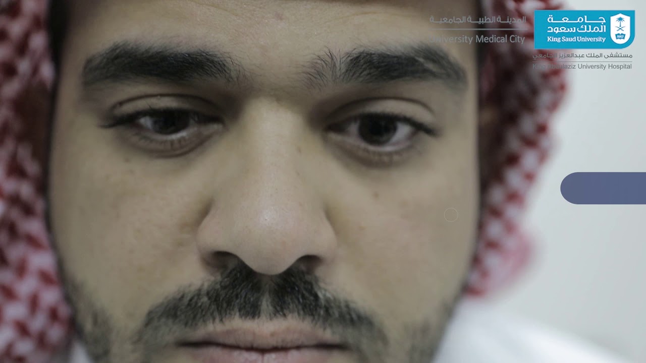 #فيديو​ حول طريقة تركيب و إخراج #العدسات_اللاصقة​ الصلبة و اللينة