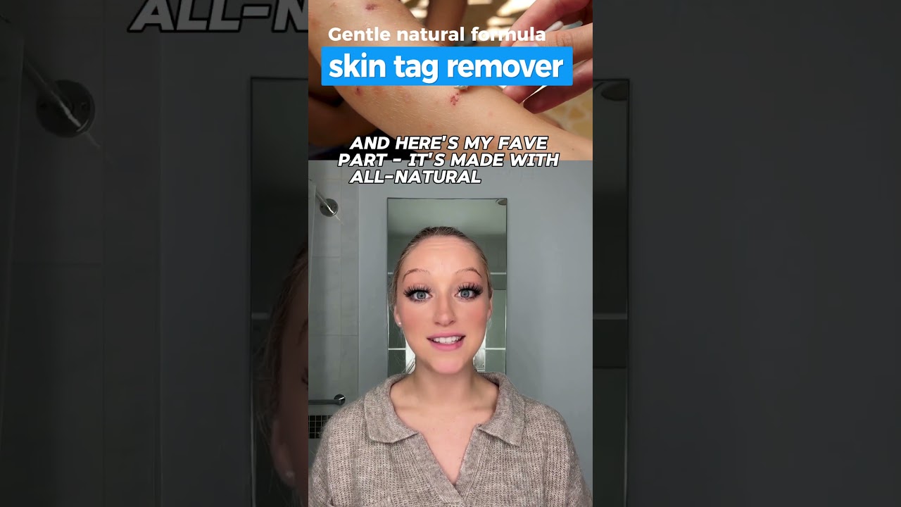 My Secret To Clear Skin Without Pain!