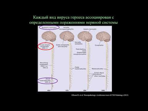 Герпетический энцефалит и другие поражения нервной системы, вызванные альфа-герпес-вирусами