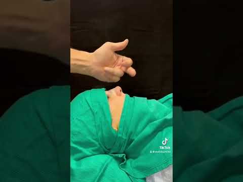 Video thumbnail: Great Nose Transformation! Operating Room Immediate Results revealed!
