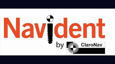 Navident: TRACE&PLACE Protocol, Dr Stefanelli, Roma