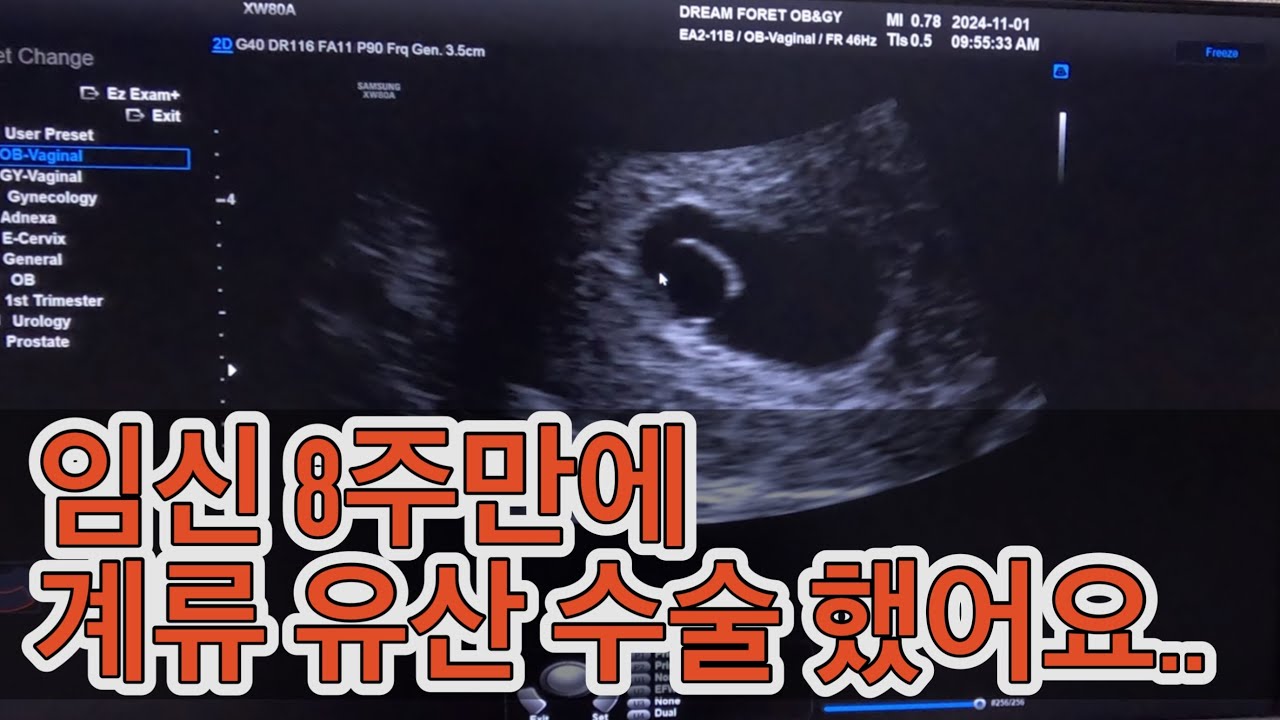 임신과 유산까지 ..8주의 행복과 슬픔의 시간들.. 잊고 싶지 않아서요.