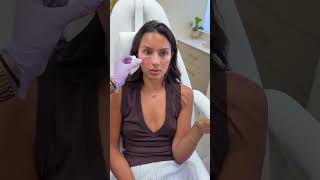 PRP vs PDGF - Which is better? 👀