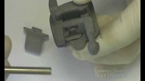 FORESTADENT QUICK - How to remove the clip part 01