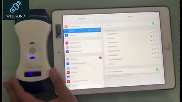 Color Double Head Wireless Ultrasound Scanner 2-in-1 Convex and Linear Probe