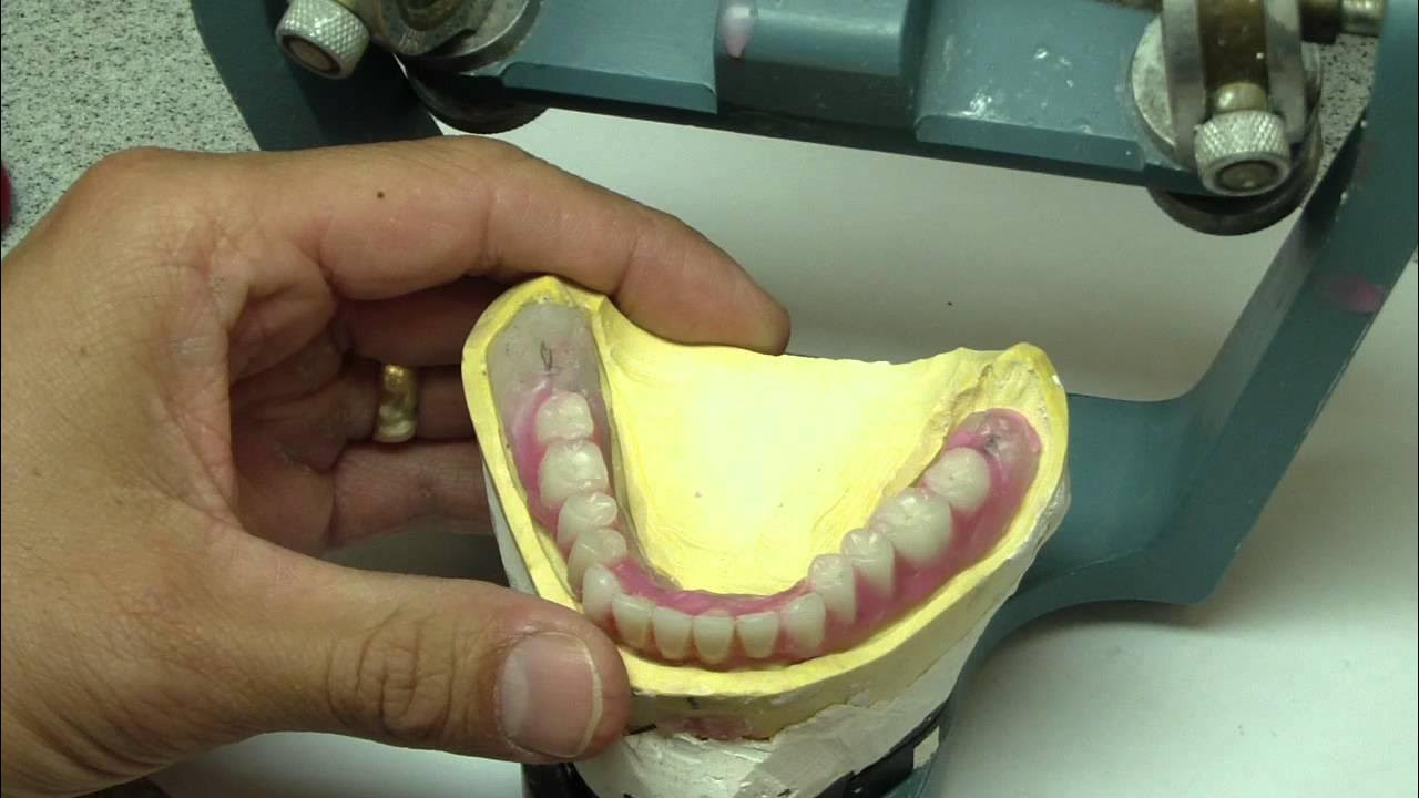 Изготовление восковых базисов. Окклюзионные валики. Базис с окклюзионными валиками. Восковой Базис с окклюзионным валиком. Окклюзионные валики высота.