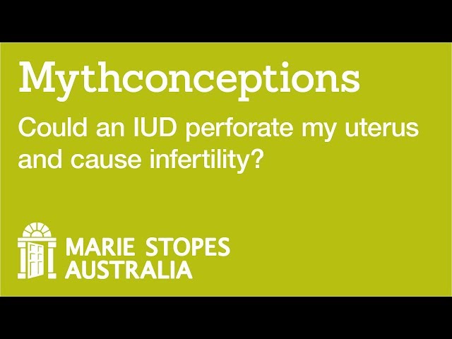 Could an IUD perforate my uterus and cause infertility?