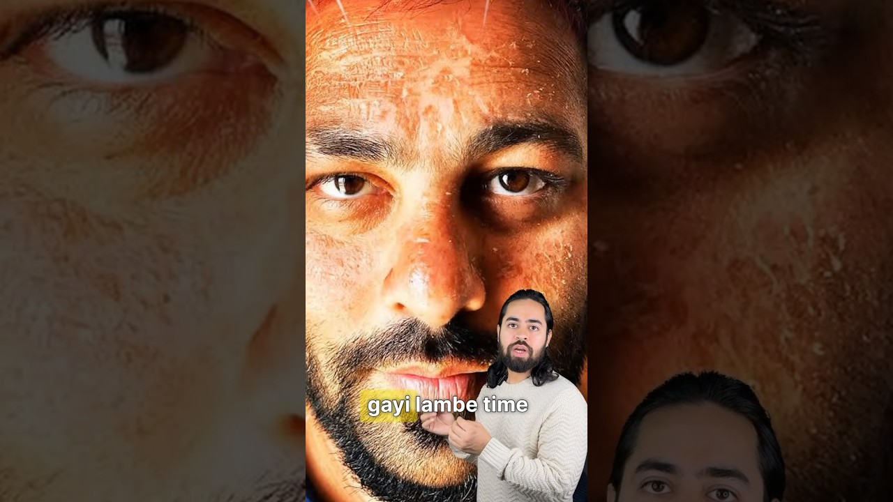 Ladke Sunscreen kyo nahi lagaate | Best sunscreen for men