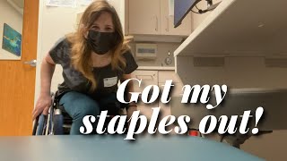 Checkup at the doctor: got my staples out! AK Amputee