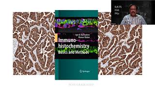 Immunohistochemistry| Pathology | RATS | MD | SRM | Dr GSS | University Exam ques! screenshot 5
