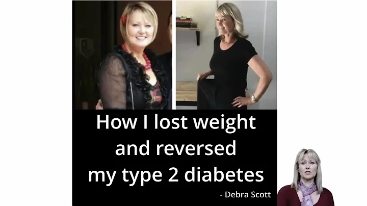 Debra Scott - 'How I lost weight and reversed my t...
