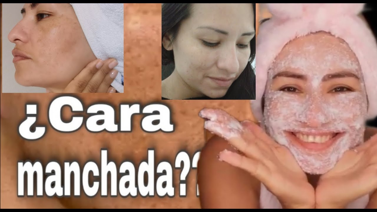 Como quitar las manchas de la piel