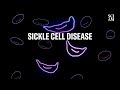 The Journey of Oxygen: Hemoglobin, Sickle Cell Disease, and Genetic Innovations