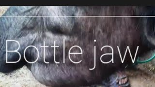 Liver fluke infestation - diagnosis, symptoms, and treatment. Dr. Umar Khan