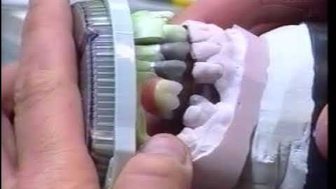 CEKA Attachment part 1