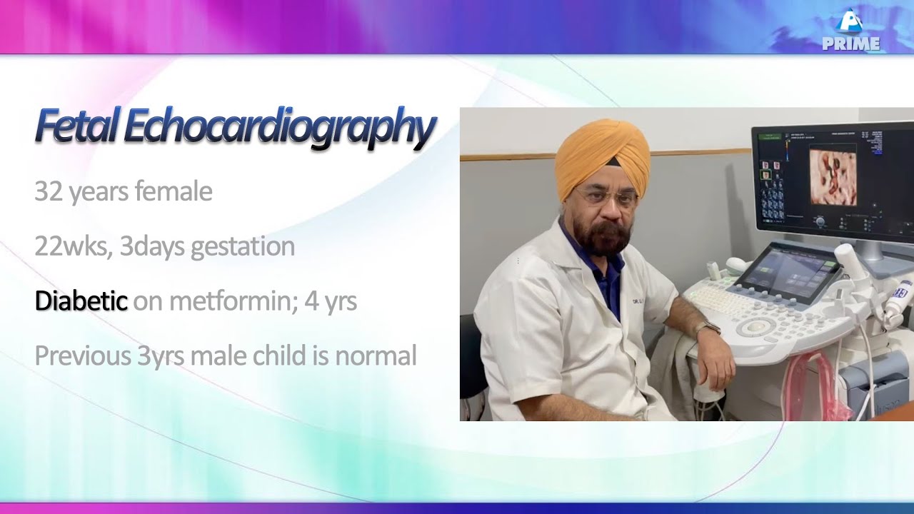 Truncus Arteriosus: Unveiling the Extraordinary & Rare Cardiac Cases