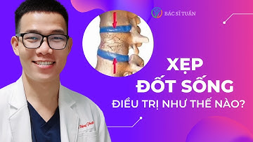 Xẹp đốt sống điều trị như thế nào? | Bác sĩ Tuấn