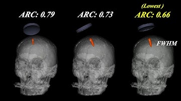 Acoustic simulation result (FWHM)