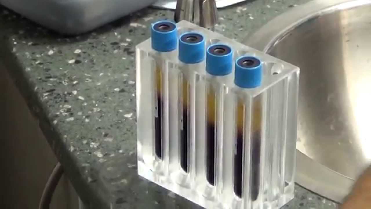 PRGF Harvest  No Audio