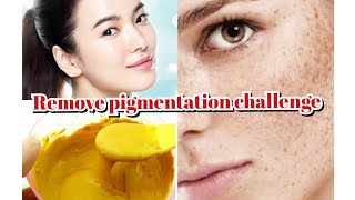 Pigmentation Face Pack/ Pigmentation Treatment At Home/ How to Remove Pigmentation/ Noor Ali