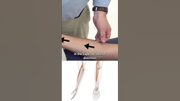 Dry Needling Brachioradialis