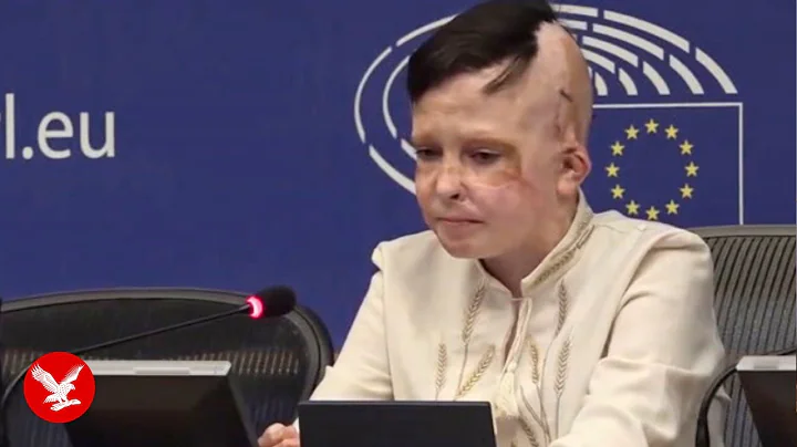 Interpreter cries as Ukrainian boy recalls mother’s death in Russian strike