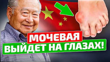 Всего 1 стакан! В Китае только так растворяют кристаллы мочевой кислоты! Подагра