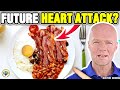 Is CHOLESTEROL BAD For You? (Real Doctor Reviews The TRUTH)