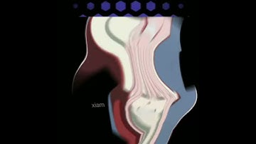 zero two edit - skechers (alight motion preset)