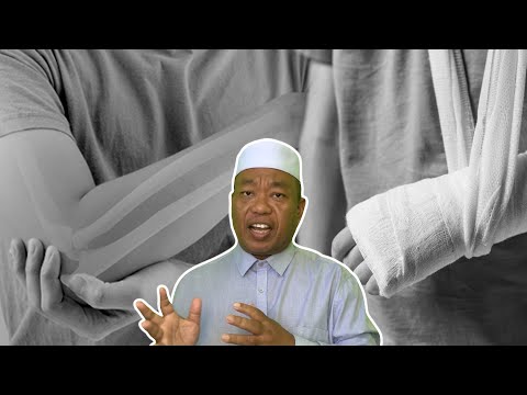 Cara Orang Dahulu Merawat Patah Tulang