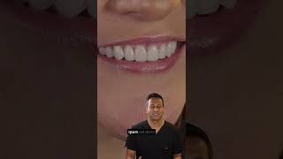 Case Review #cosmeticdentistry #dentist #veneers #newsmile