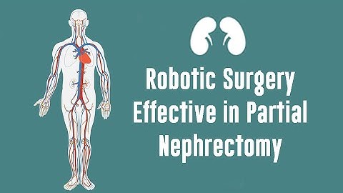 Robotic Surgery Effective in Partial Nephrectomy - Dr. Webb McCanse