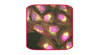 How to optimize your acquisition using Mica’s intelligent imaging