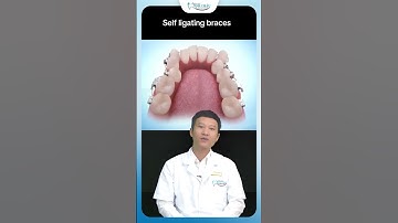 Các Bước Niềng Răng Để Có Một Hàm Răng Đẹp | Bác Sĩ Yên