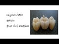 பல்லு வலி சிக்கிரம் குணமாக(how to stop tooth pain at home) 