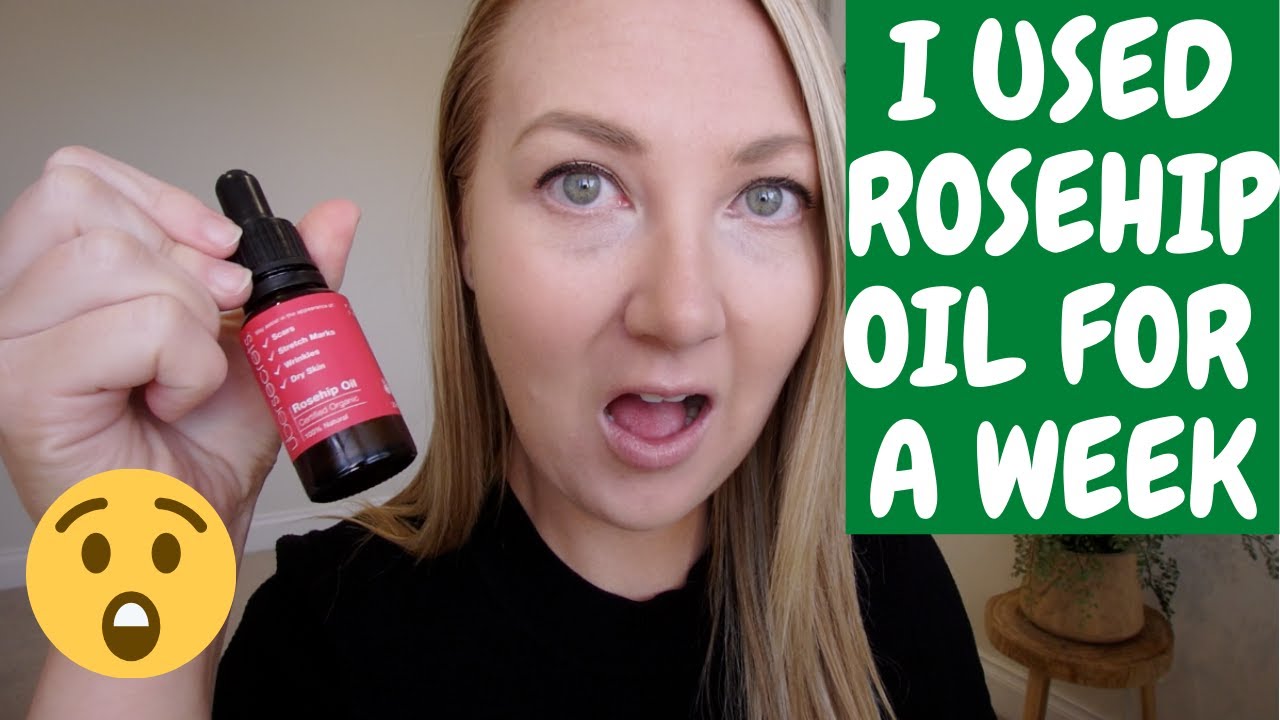 Adding ROSEHIP OIL TO YOUR SKIN CARE ROUTINE! You Wont Believe the Results!!