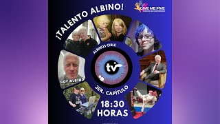 ¡Talento Albino!