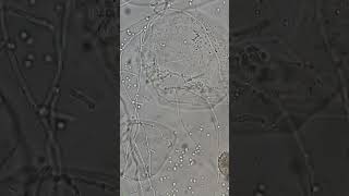 Host Cells And Fungal Interaction