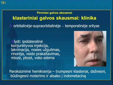 Video: Depresiniai Galvos Skausmai: Priežastys, Simptomai Ir Gydymas