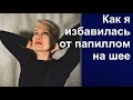 Как я избавилась от папиллом на шее