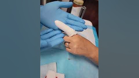 How To: Best Practice Finger Laceration Wound Dressing