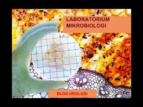 Video: Sel Epitel Dalam Urin: Jenis, Hasil Tes, Penyebab, Dan Banyak Lagi