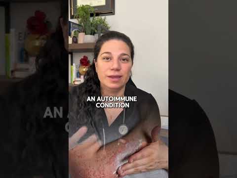 The GALT Connection You Need to Know ytshorts shorts by Fertility Mom