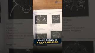 Radiology Made Easy: Practice Cases for MD/DNB Residents | Dr. Zainab Vora